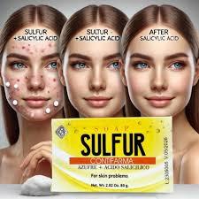 Best Sulfur Soap with Salicylic Acid ...